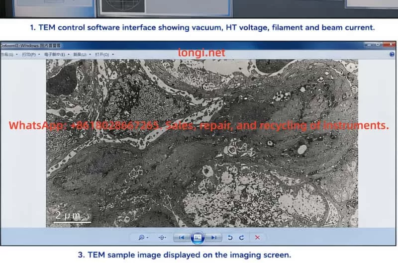 Transmission electron microscope sample image displayed on a monitor, showing high-magnification grayscale cellular ultrastructure captured by a JEOL JEM-1400 TEM system.